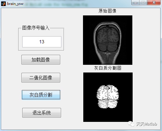 【江南体育下载】医疗影像处理中的计算机视觉技术进展