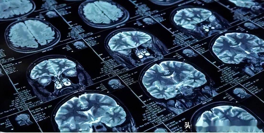 医疗影像处理中的计算机视觉技术进展
